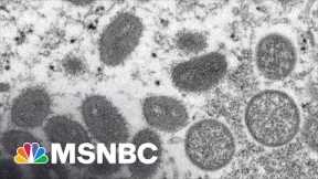 CDC Warns Of Monkeypox. Here’s How It Spreads.