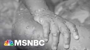 How Worried Should You Be About Monkeypox? | The Mehdi Hasan Show