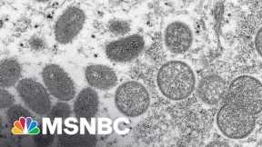 BREAKING: WHO Declares Monkeypox A Global Emergency