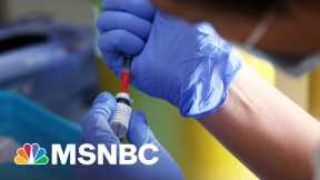 Monkeypox, What It Is, Who It Affects And What You Can Do To Protect Yourself